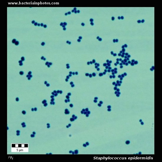 Staphylococcus epidermidis   
                         microscopy, gram-positive bacteria